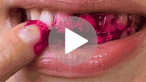 DentaBiome FabM acid-lock science demo