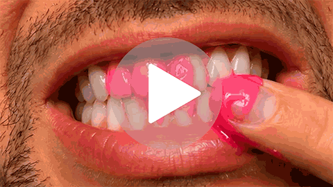 DentaBiome oral microbiome balance demo
