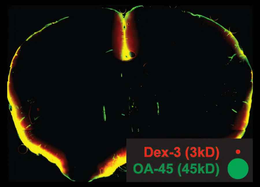 Older brain reduced clearance
